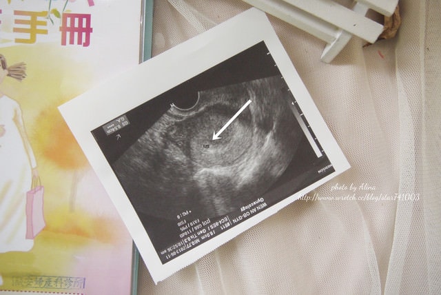 20251023-yd1k0 20251023-yd1k0