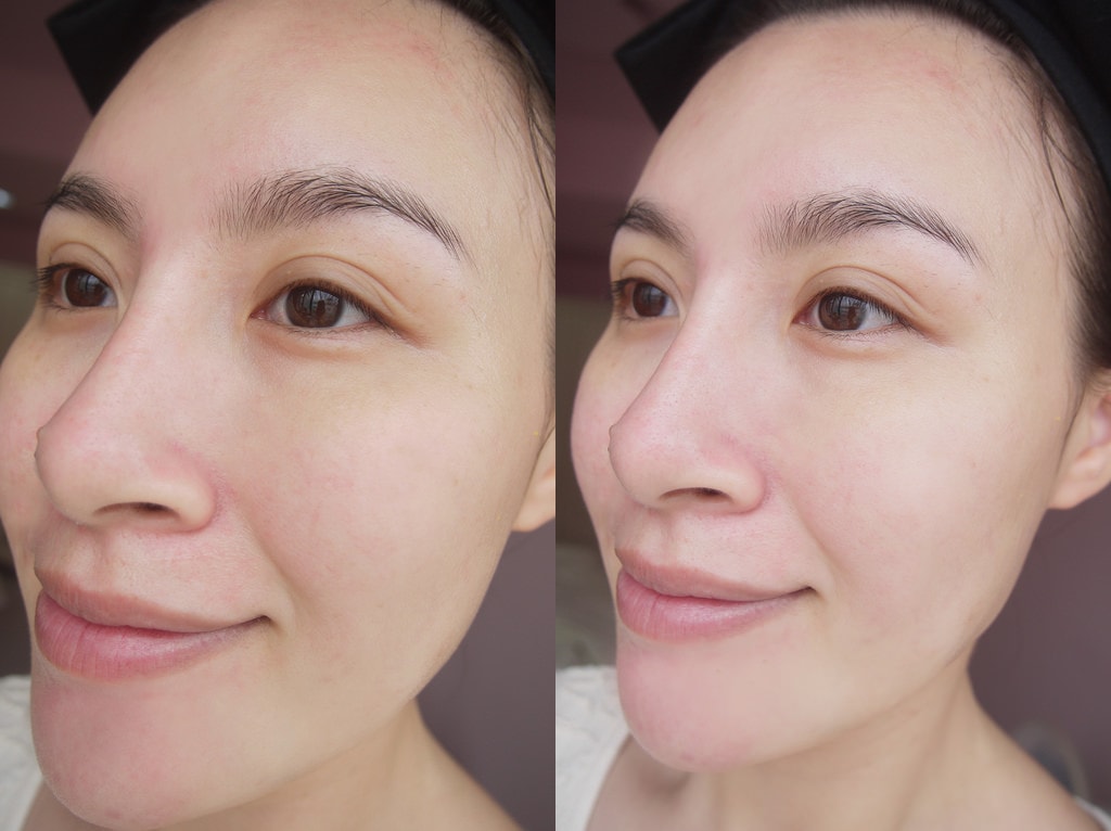 20251023-ersrh 20251023-ersrh